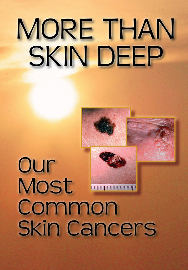 Skin_Cancer_DVD_Jacket